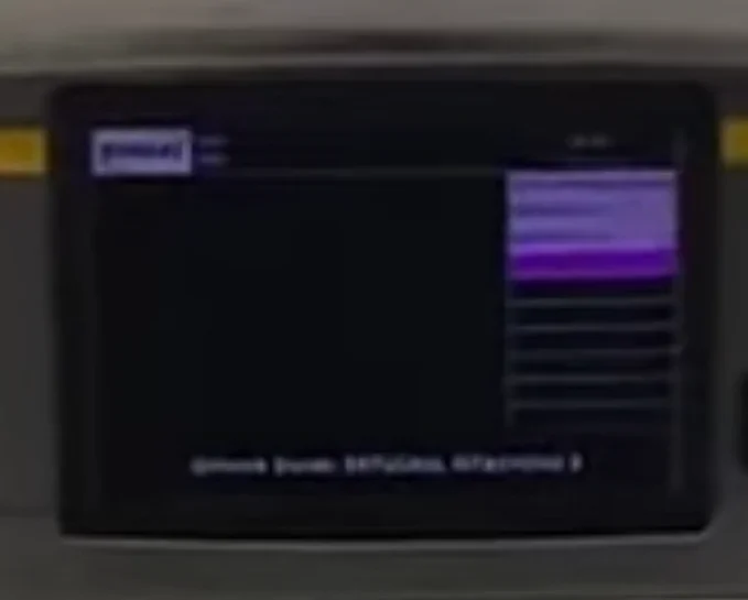 Screenshot_20251031_151343_YouTube.webp Screenshot_20251031_151343_YouTube.webp